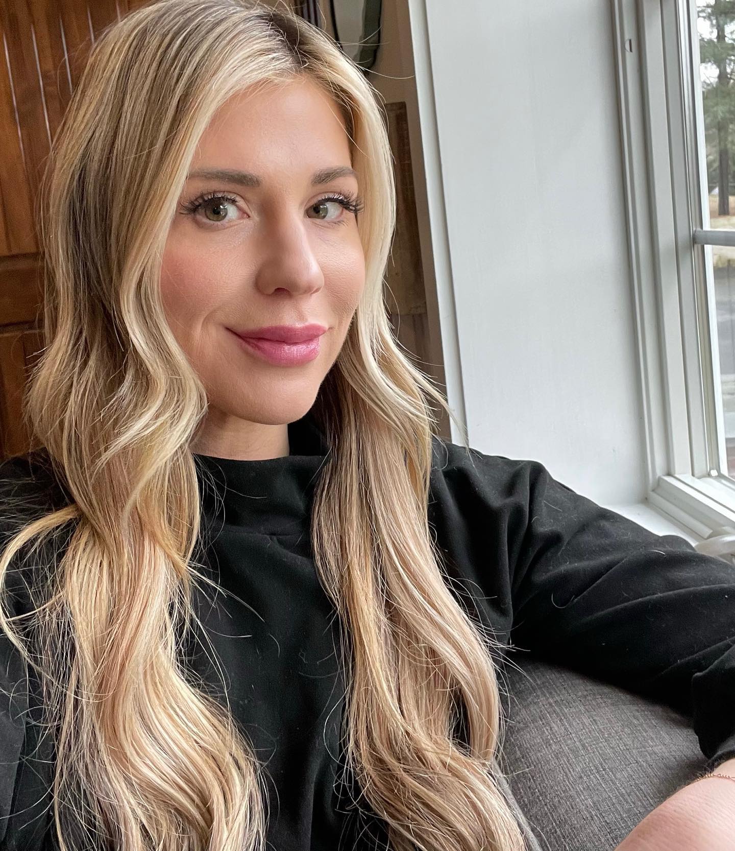 Patient selfie showing natural-looking results