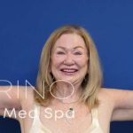Arm Lift Before & After Patient #1101