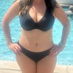 Liposuction Before & After Patient #641