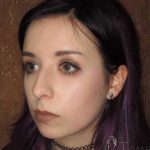 Rhinoplasty Before & After Patient #1439