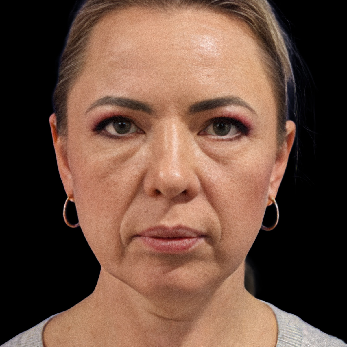 Patient portrait before treatment