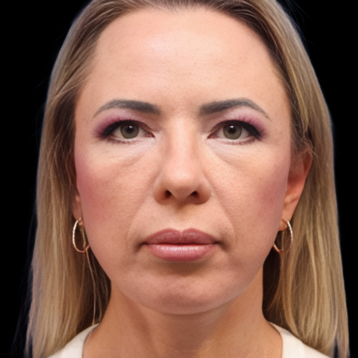 Patient portrait after treatment